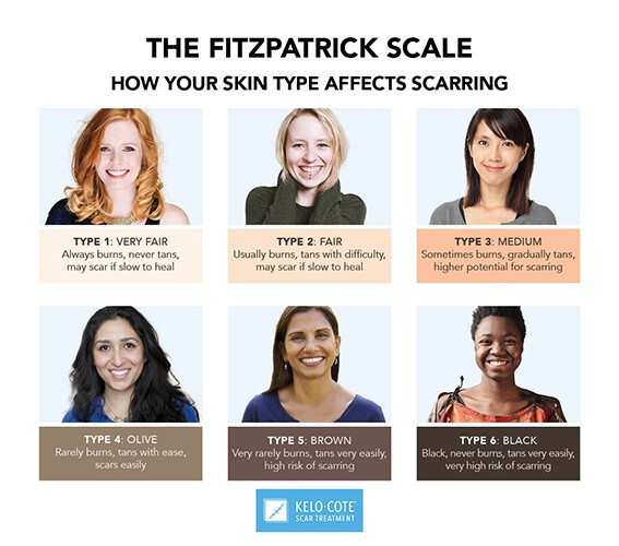 Know Your Skin Type: Know Your Hypertrophic or Keloid Scar - Alliance ...